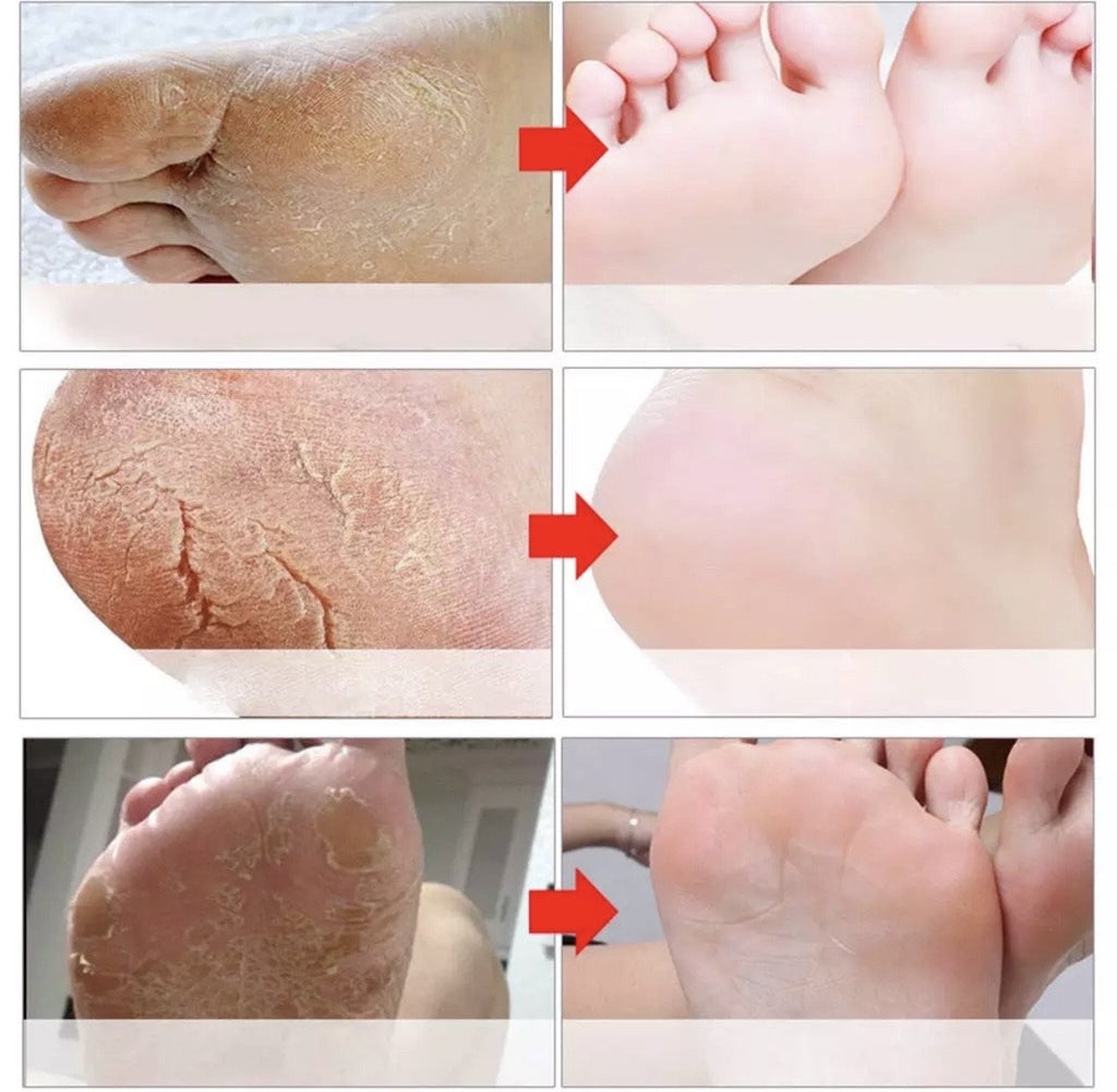 Exfoliating Peel Off Foot Mask Remove Hard Dead Skin Callus Sock Baby Soft  Feet