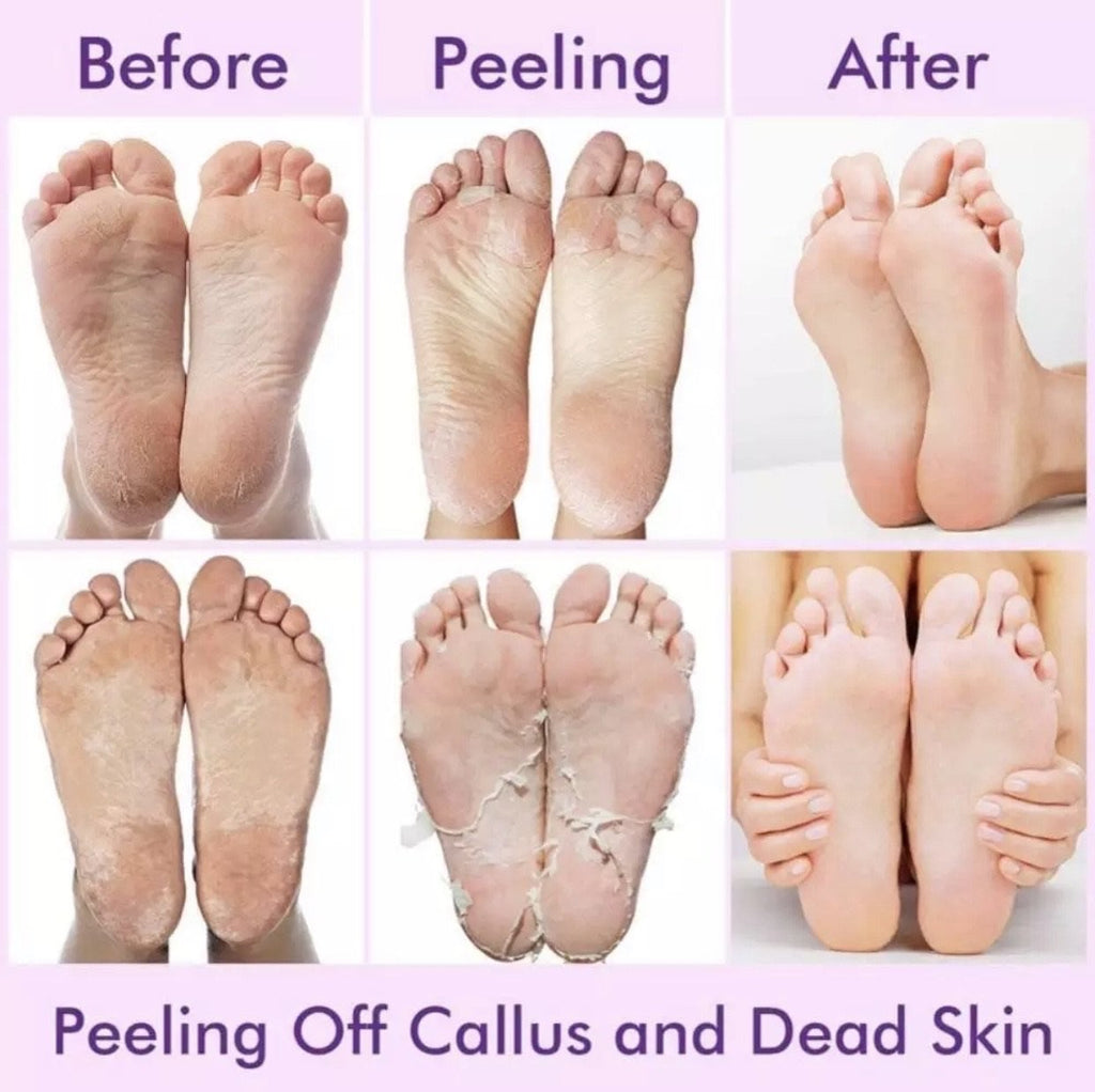 Soft Touch Foot Peel Mask, Exfoliating Callus Remover (2 Pairs Per Box) Cracked Heels, Dead Skin Treatment for Baby Soft Feet